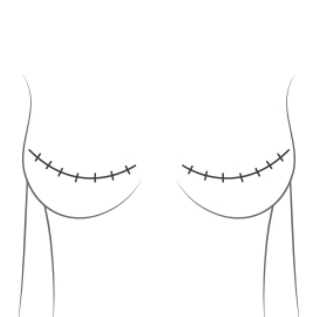 Image du participant